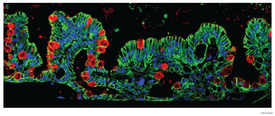 MIM002 Figure 4. Human Ascending Colon Adult Stem Cells Differentiate into Ascending Colon Tissue
