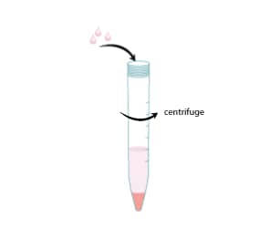 Collect cells when density reaches 1.5 – 2.5 x 106 centrifugation at 1500 rpm for 5 minutes.