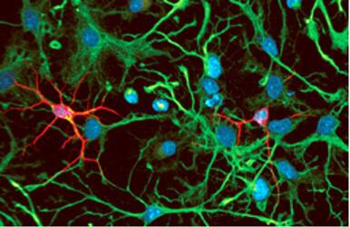 Rat cortical stem cell staining using NortherLights secondary antibodies