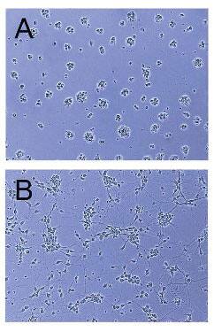 Recombinant Human C-Terminal Slit3