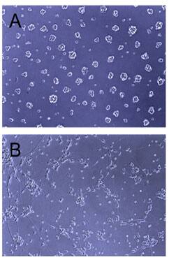 Recombinant Human Slit2