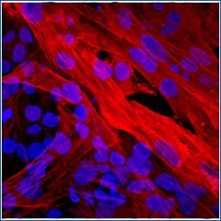 Immunocytochemistry/Immunofluorescence image of alpha-SMA antibody