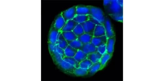 Immunocytochemistry/Immunofluorescence image of E-Cadherin antibody