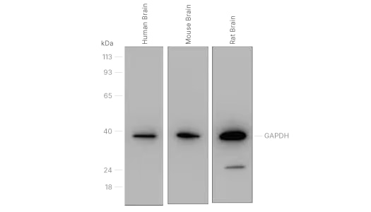 Figure 3: Western blot analysis of insulin-induced signal transduction molecules in brain tissue.