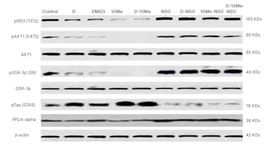 Figure 4: Western blot 