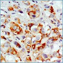 Immunohistochemistry analysis of MUC-1 antibody