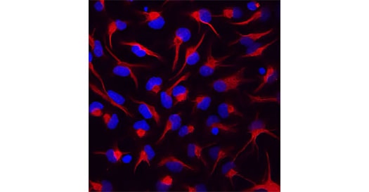 Immunocytochemistry/Immunofluorescence image of Vimentin antibody