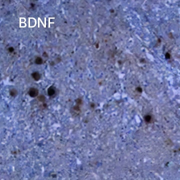 BDNF 