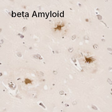 beta Amyloid Antibody 
