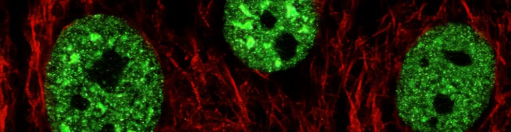 Epigenetic control of Autophagy banner