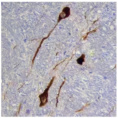 Tyrosine hydroxylase expression in human brain medulla, IHC