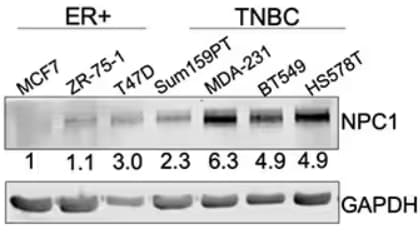 WB analysis of NPC1 expression in ER+ breast cancer cells vs. TNBC cells.