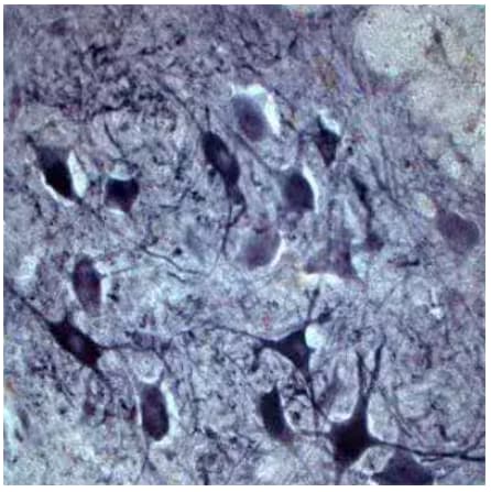 ChAT expression in rat spinal cord neurons, IHC
