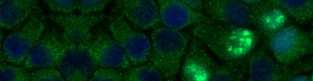 ATG5 expression in HeLa cells, ICC, Immunofluorescence, visualized with anti-rabbit Dylight and stained with DAPI