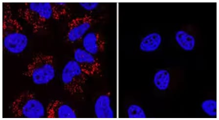 ICC analysis of LC3B expression in Chloroquine treated HeLa cells.