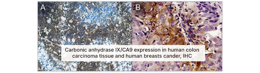 Carbonic anhydrase IX/CA9 expression serves as a marker for hypoxia. Expression of Carbonic anhydrase IX/CA9 is regulated by HIF