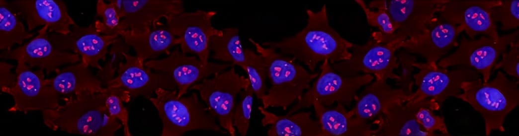 Chaperone Mediated Autophagy (CMA) does it all! Banner