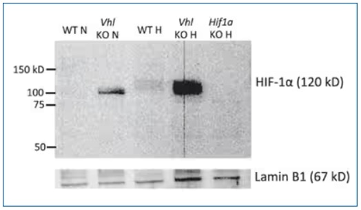 HIF-1 alpha expression in CD4+ T cells from wildtype, VHL-knockout and HIF-knockout mice under normoxic and hypoxic conditions. 