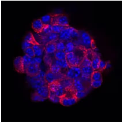Fluorescent ICC imaging of insulin expression in beta TC-6 mouse beta cell insulinoma cell line.