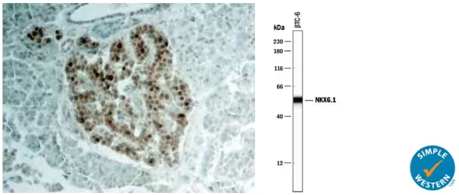 Expression of NKX6.1 in IHC of human pancreas and Simple Western of beta TC-6 mouse cell line.