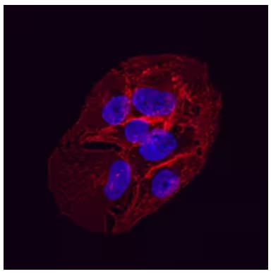 Immunocytochemical analysis of GluT1 expression in HepG2 carcinoma cell line.