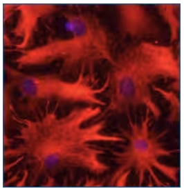Figure 2. Immunostained rat astrocytes. 