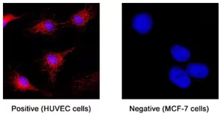 ICC analysis of ST2/IL-33R expression in HUVEC and MCF-7 cell lines using LlaMABody antibodies.