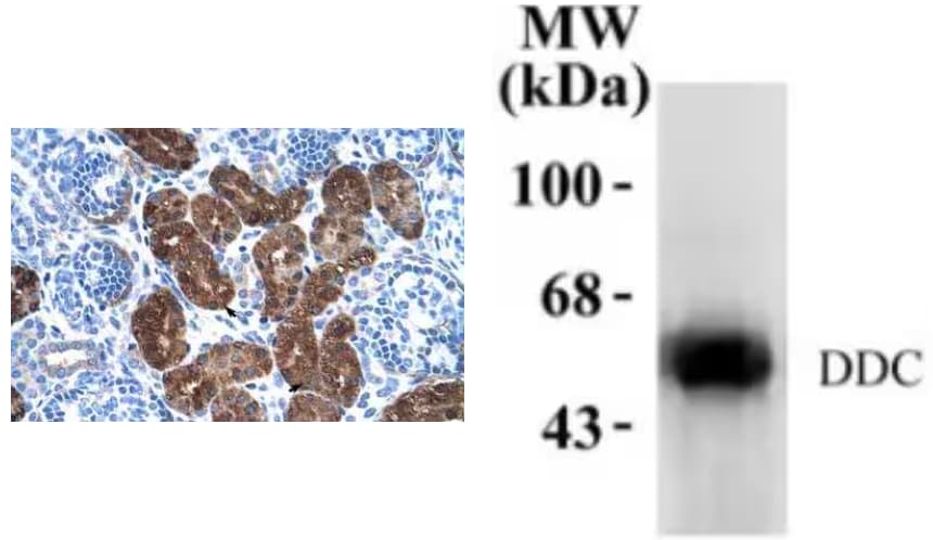 IHC and WB analysis of DCC antibody.