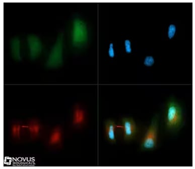 LC3B and alpha-tubulin expression in HeLa cells, ICC, Immunofluorescence, staining with Dylight 488. Dylight 550, and DAPI solut