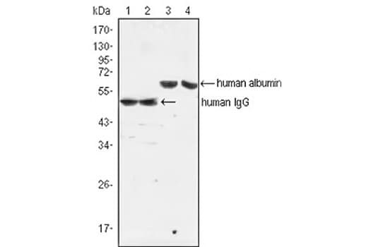 Western blot analysis of IgG and albumin expression against human serum and plasma.