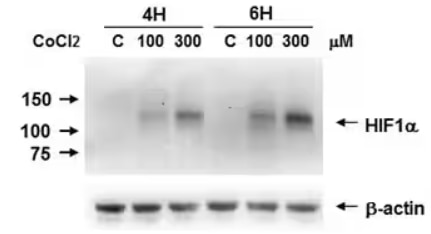 WB analysis of Caki-1 cells treated with or without CoCl2 to induce HIF-1a expression.