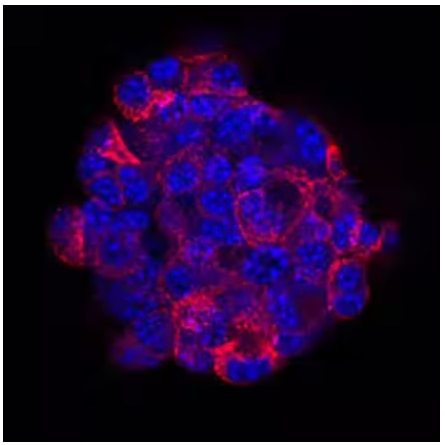 ICC analysis of insulin expression in TC-6 mouse beta cell insulinoma cell line.