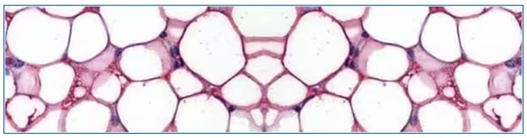 Insulin signaling in adipocytes banner
