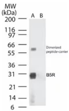 WB analysis of Smallpox B5R in recombinant fusion proteins with and without amino acids 180-194.