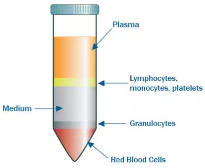 Isolation of immune cells from whole blood cells is possible by the use of a density gradient medium upon which whole blood cell