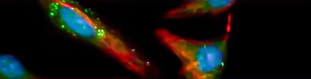 LC3A Express Hela Cells