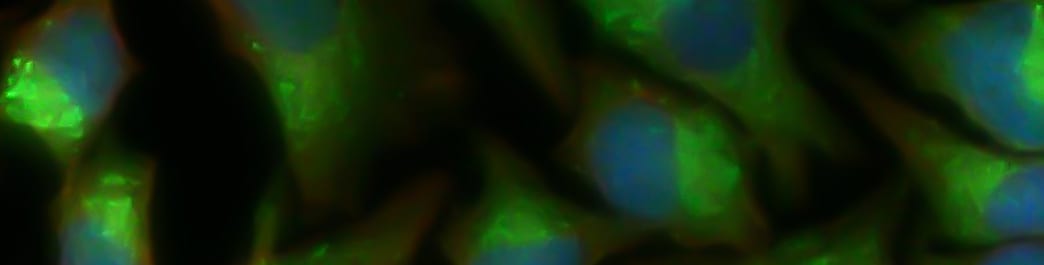 lc3b-express-hela-cells-banner.jpg