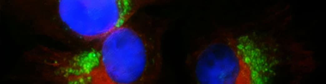 lc3b-expression-hela.jpg