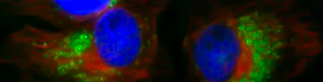 Autophagy and RAS signaling banner