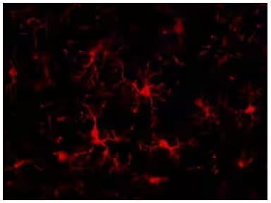 mapk-signaling-links-autophagy-and-inflammation-fig-2