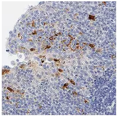 IHC analysis of IL-1 beta/IL-1F2 expression in human tonsil tissue.