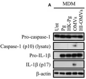 WB analysis of induced inflammasome signaling and pyroptosis in human macrophages.