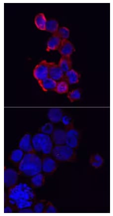 ICC staining of human THP-1 cells treated or untreated with PMA and LPS and probed with NLRP2 antibody.