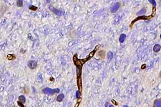 Immunohistochemical analysis of MHC Class I expression