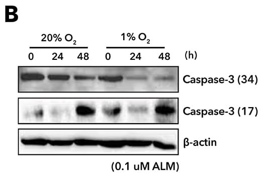 Immunocytochemical detection of caspase-3 in immersion fixed Jurkat human acute T cell leukemia cell lines treated with Staurosp