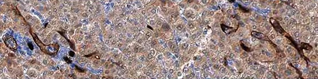 nb-blog-cd34-ihc-af7227-banner.jpg