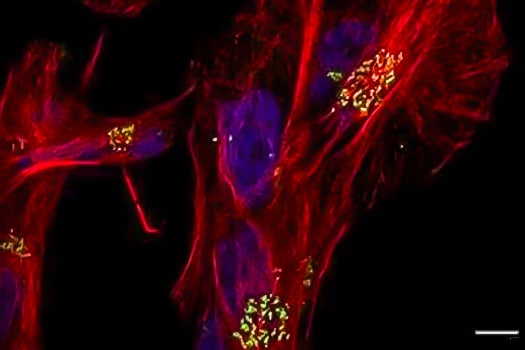 Immunocytochemical analysis of Alexa Fluor® 488-conjugated TGN46 antibody (green) and tubulin (Alexa Fluor® 594, red) in T98G gl