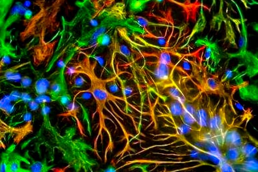 Oligodendrocytes