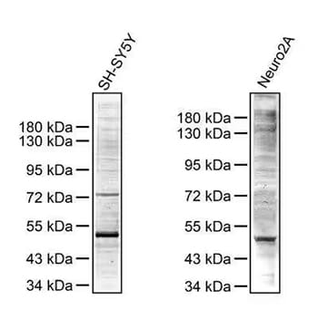 Western blot analysis showing phosphoserine expression in SH-SY5Y (left) and Neuro2A (right) whole cell lysates using Rabbit Ant