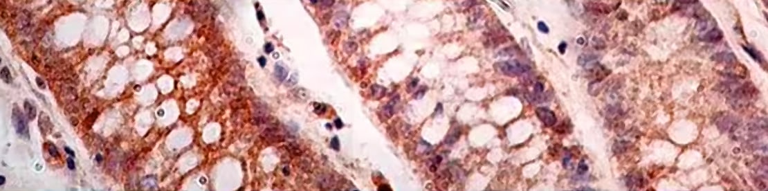 Pyroptosis banner